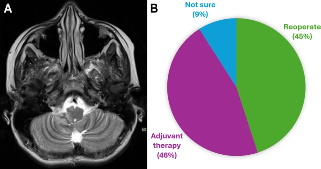 381 2026 7355 Fig1 HTML - Society for Pediatric Neurosurgical Oncology